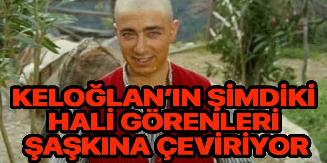 Keloğlan'ın şimdiki hali görenleri şaşkına çeviriyor