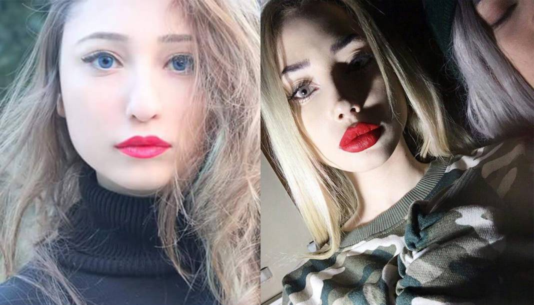 TikTok fenomenlerinin eski ve yeni estetikli halleri "TikTok'ta gömü var!" dedirtti! Mika Raun, Yaren Alaca, Taha Duymaz, Merve Yalçın, Uzun Makarna... 10