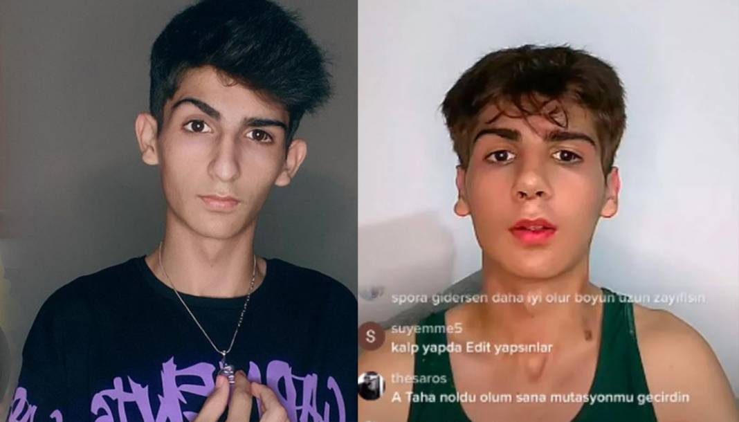 TikTok fenomenlerinin eski ve yeni estetikli halleri "TikTok'ta gömü var!" dedirtti! Mika Raun, Yaren Alaca, Taha Duymaz, Merve Yalçın, Uzun Makarna... 5