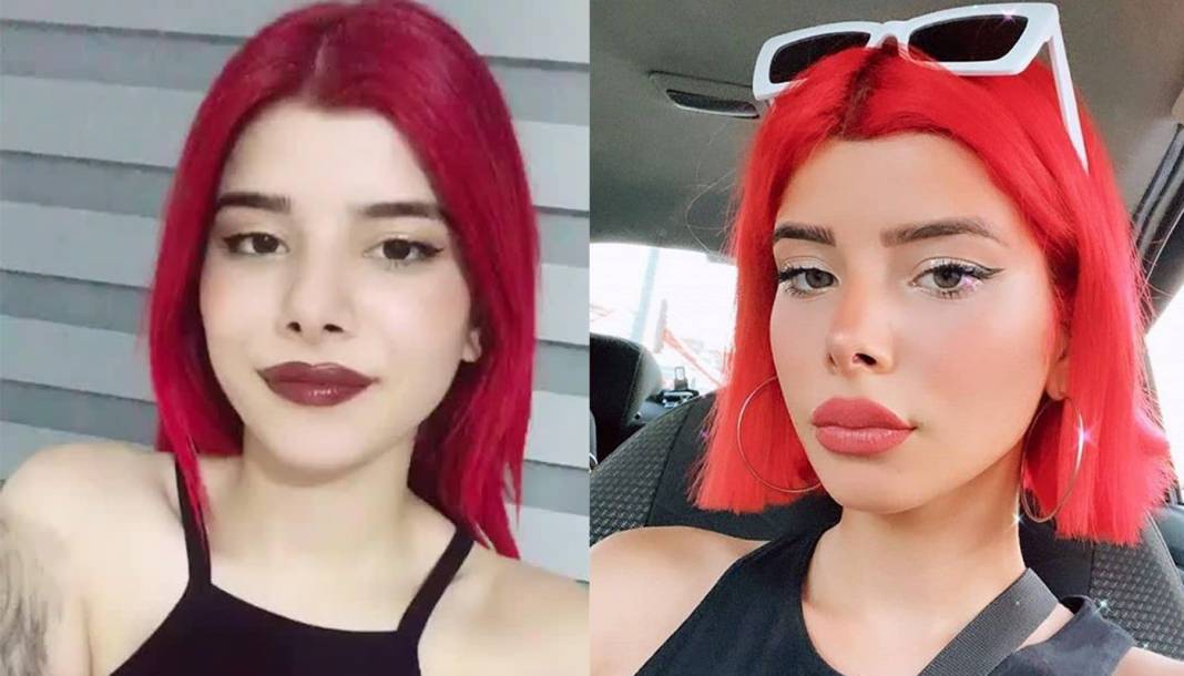 TikTok fenomenlerinin eski ve yeni estetikli halleri "TikTok'ta gömü var!" dedirtti! Mika Raun, Yaren Alaca, Taha Duymaz, Merve Yalçın, Uzun Makarna... 7