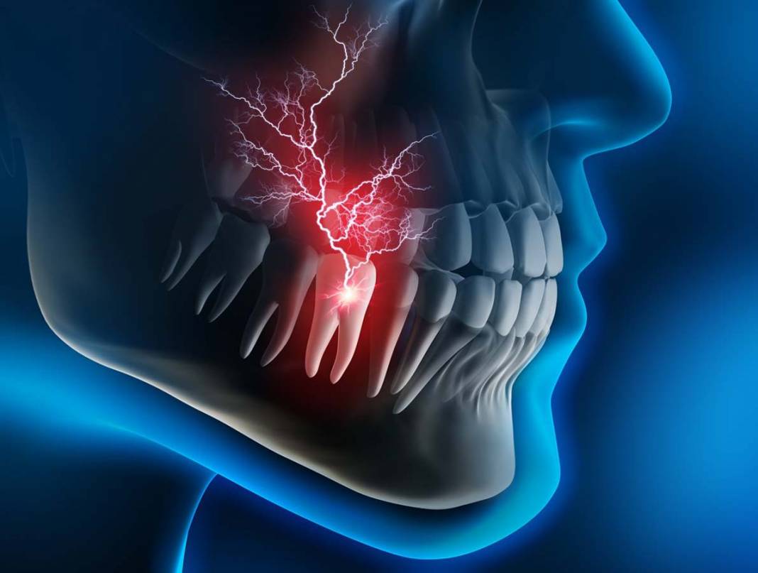 Doktor koltuğundan korkup kaçanlara! Diş ağrısına evde uygulanacak geçici yöntemler! 8