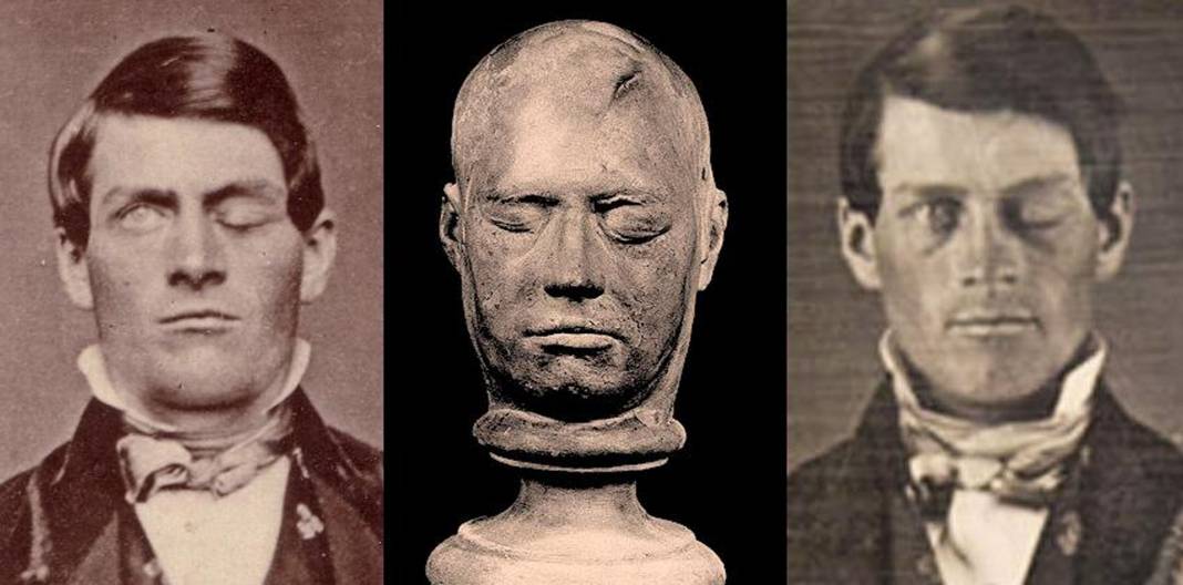 Kafatasını delen demir çubuk nedeniyle beyninin büyük bir kısmını kaybetmesine rağmen yaşamına devam eden Phineas Gage'in garip hikayesi... 1