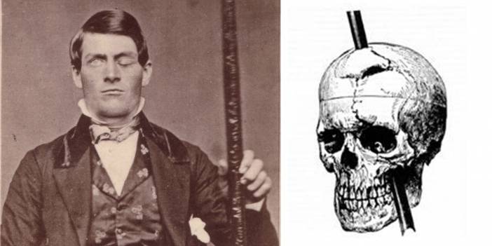 Kafatasını delen demir çubuk nedeniyle beyninin büyük bir kısmını kaybetmesine rağmen yaşamına devam eden Phineas Gage'in garip hikayesi...