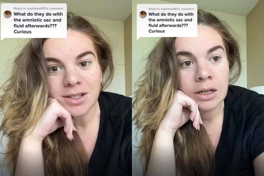 Böylesi görülmedi! Genç annenin doğurduğu bebek tekrar karnına koyuldu! "Bu nasıl mümkün olabilir, aklım almıyor!" 4