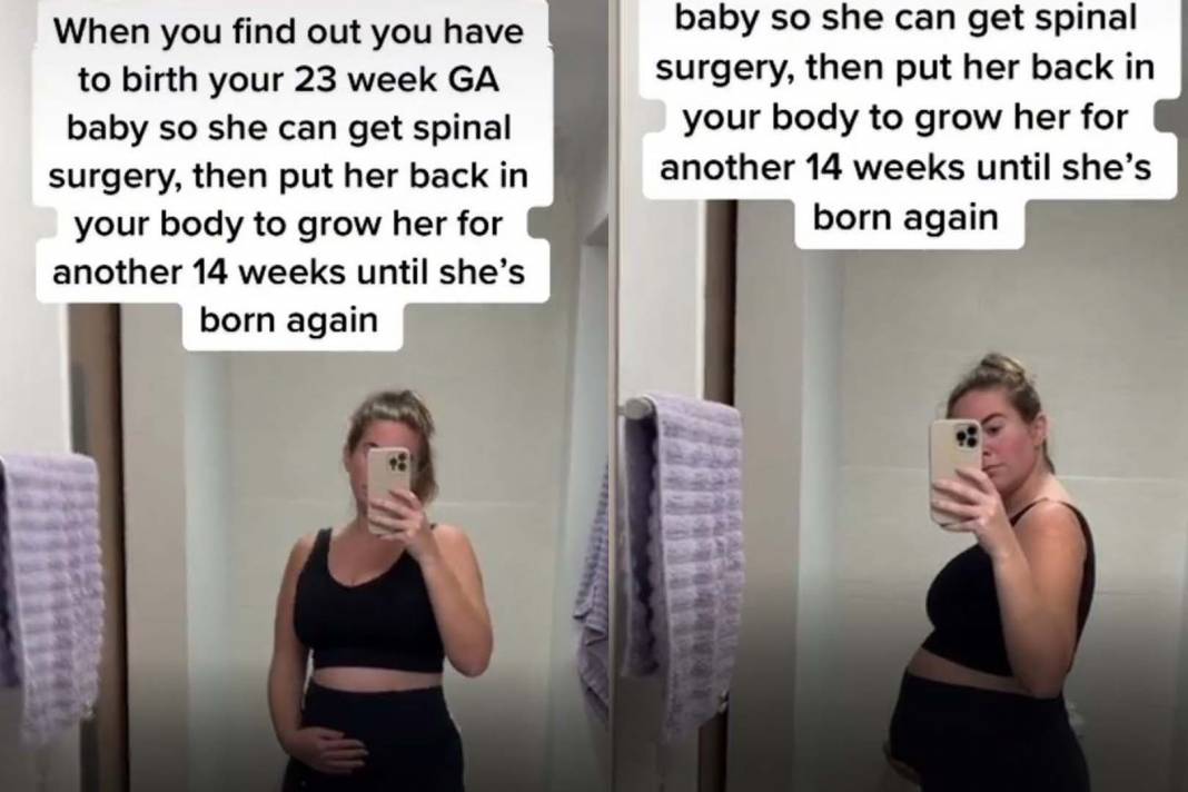 Böylesi görülmedi! Genç annenin doğurduğu bebek tekrar karnına koyuldu! "Bu nasıl mümkün olabilir, aklım almıyor!" 6