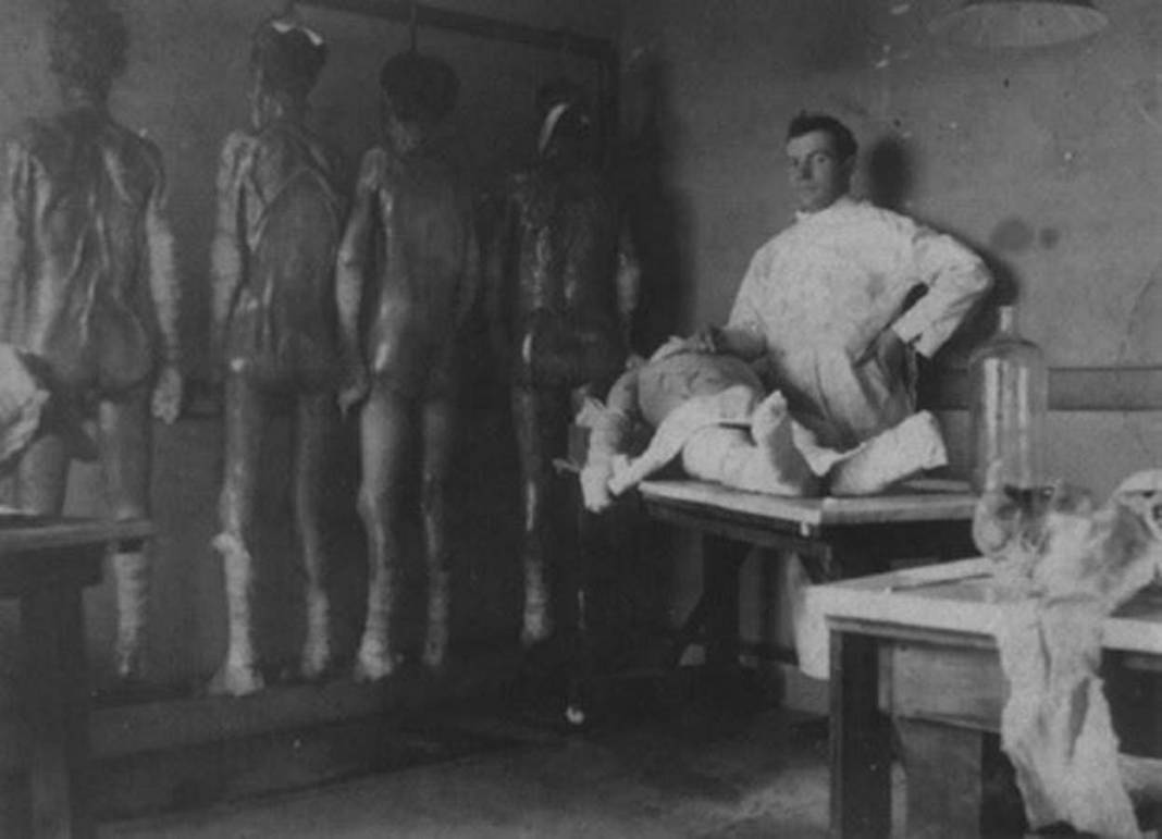 Kurbanlarına narkoz vermeden organlarını parçalayan, siyam ikizi yapmak için birbirlerine diken psikopat doktor: Josef Mengele 6