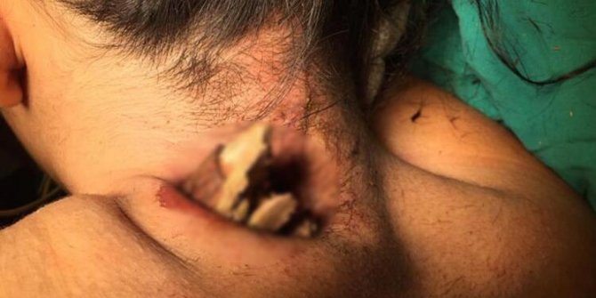 Korkunç kaza! Boynundan girip koltuk altından çıktı