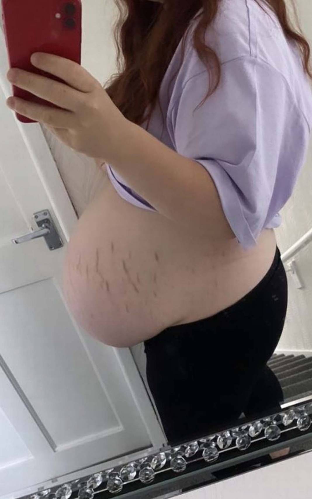 Yeni doğum yapan anne, bebeğini görünce gözlerine inanamadı! Bebeği o kadar büyüktü ki... 1