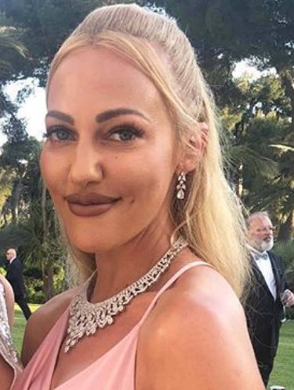 Görenler tanıyamadı! Muhteşem Yüzyıl'ın Hürremi, Meryem Üzerli estetiğin dozunu kaçırdı! 10