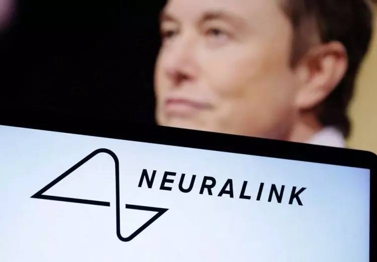 Bilim kurgu değil, gerçek! Elon Musk'ın Neuralink şirketi onay aldı: Beynine çip taktırmak isteyen insanlar aranıyor! 11