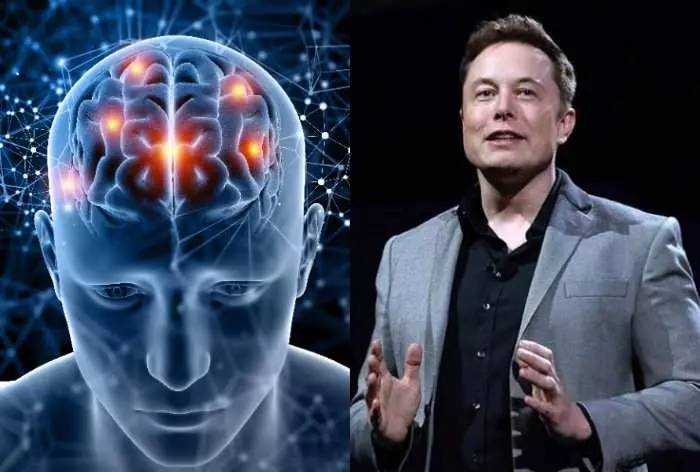 Bilim kurgu değil, gerçek! Elon Musk'ın Neuralink şirketi onay aldı: Beynine çip taktırmak isteyen insanlar aranıyor! 3