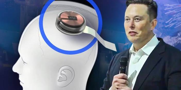 Bilim kurgu değil, gerçek! Elon Musk'ın Neuralink şirketi onay aldı: Beynine çip taktırmak isteyen insanlar aranıyor!