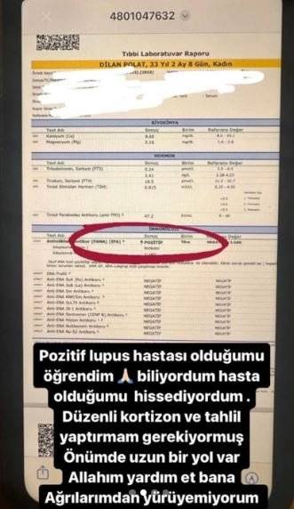 Ünlü fenomen Dilan Polat tedavisi yok dedi, ağlayarak hastalığını duyurdu, Dilan Polat'ın  Lupus hastalığı nedir? 6