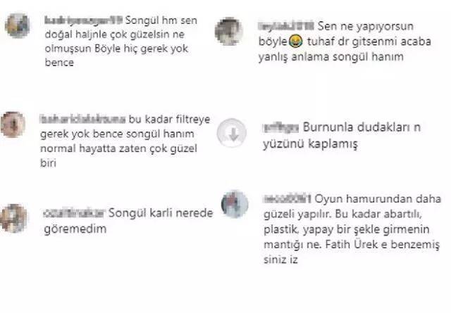 Songül Karlı, estetik sonrası son halini paylaşınca olanlar oldu! ''Gerçekle alakan yok'' 8