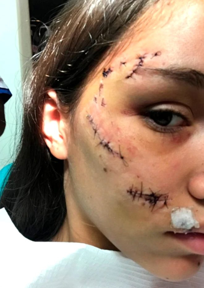 Köpek ile fotoğraf çektirmek isteyen kız, az kalsın suratını kaybediyordu! 4