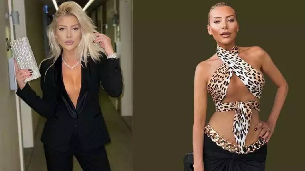 Gülşah Saraçoğlu'nun estetik ameliyatı 9 saat sürdü: Son halini paylaştı, görenleri şok etti! 1
