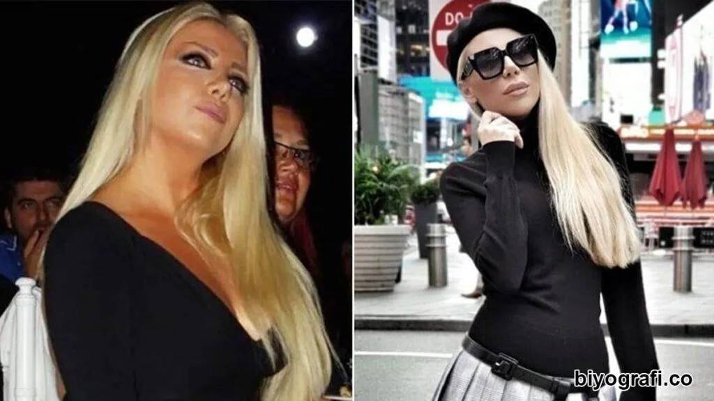 Gülşah Saraçoğlu'nun estetik ameliyatı 9 saat sürdü: Son halini paylaştı, görenleri şok etti! 7