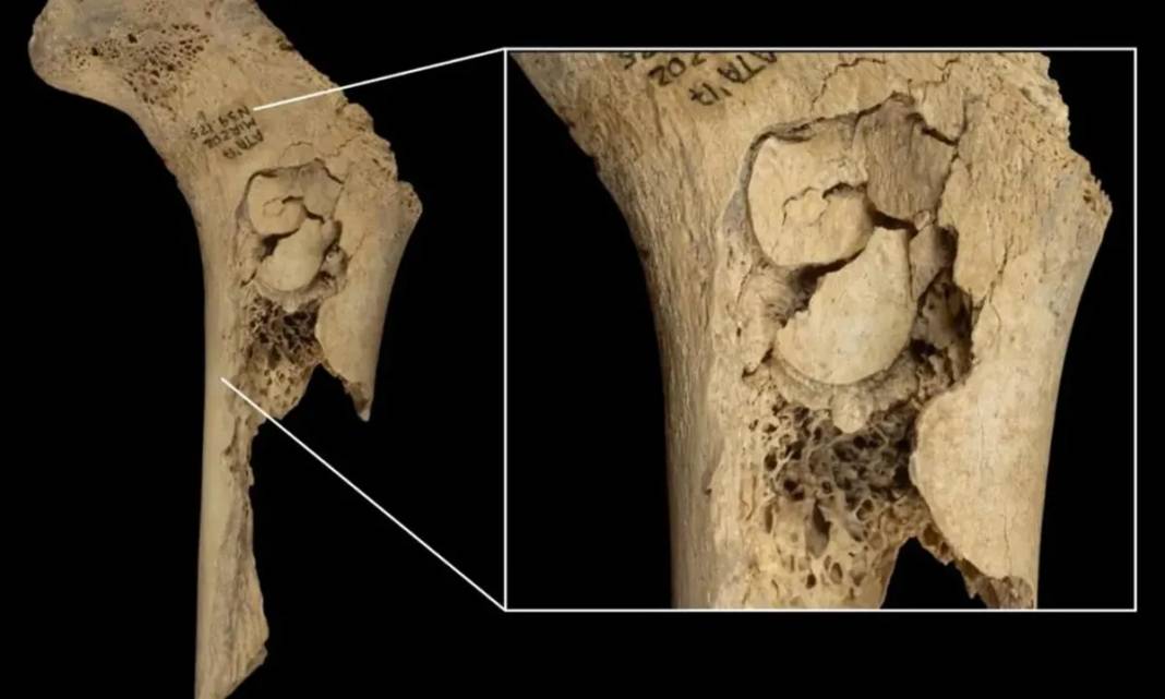 Yamyamlık mı işkence mi? 5.700 yıllık pişirilmiş insan kalıntıları ortaya çıktı! 5