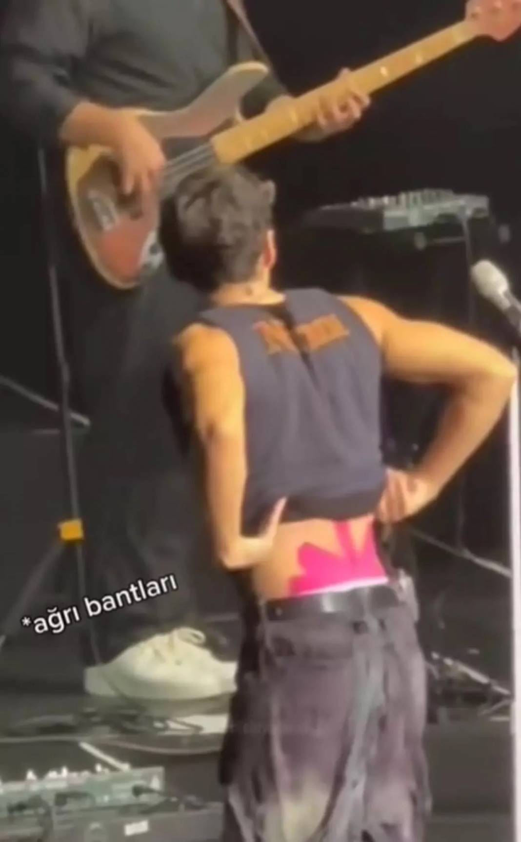 Edis sahnede açıp gösterdi: Hastalığını ilk kez açıkladı 3