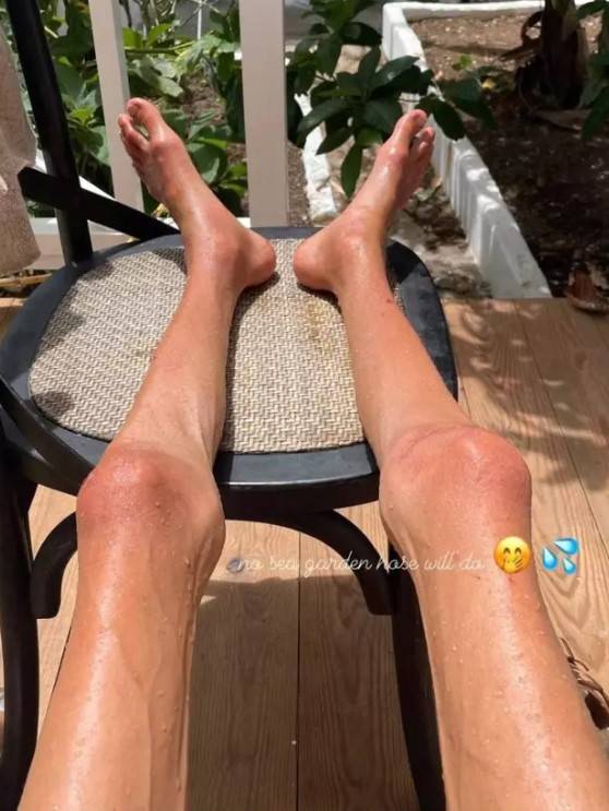 Meyve diyetiyle 20 kiloya düşmüştü: O, Sosyal medya fenomeni hayatını kaybetti! 3