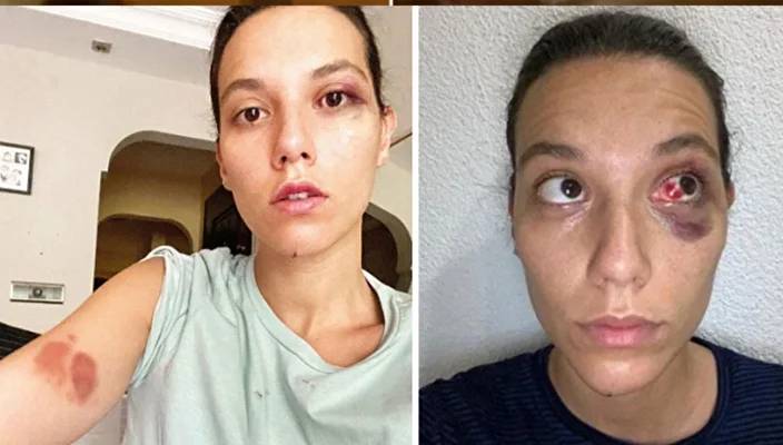 Sosyal medya bu olayla sallanıyor: Ozan Güven’i Deniz Bulutsuz neden protesto etti? 3