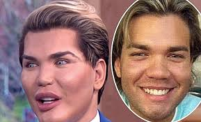 Ken Bebek Rodrigo Alves şimdi de kadın olmaya karar verdi ve tanınmaz bir hale döndü 13