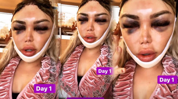 Ken Bebek Rodrigo Alves şimdi de kadın olmaya karar verdi ve tanınmaz bir hale döndü 9