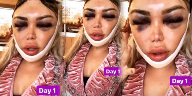 Ken Bebek Rodrigo Alves şimdi de kadın olmaya karar verdi ve tanınmaz bir hale döndü