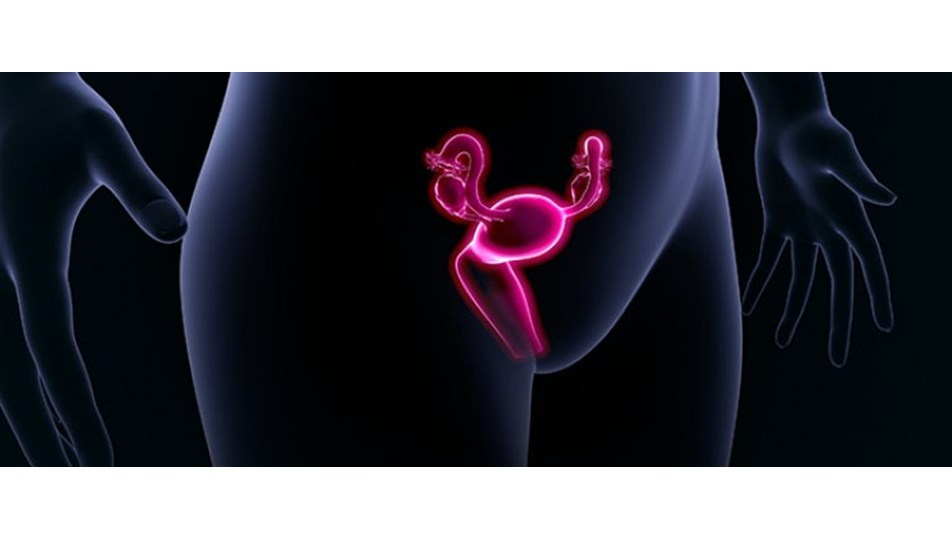 Yumurtalık kanserinin herhangi bir belirtisi yok, sinsice ilerliyor 7