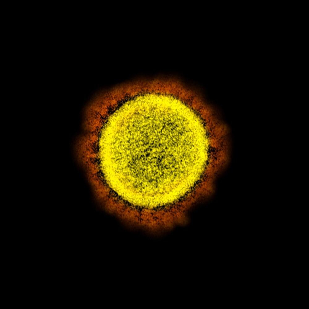 Kovid-19 insan hücrelerine ne yapıyor? Laboratuvar ortamında adım adım görüntülendi 10