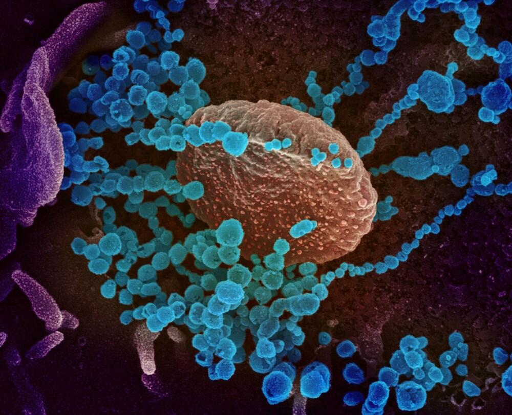 Kovid-19 insan hücrelerine ne yapıyor? Laboratuvar ortamında adım adım görüntülendi 2