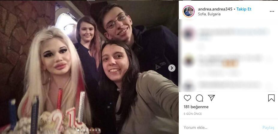 22 yaşındaki genç kız yaptırdığı dudak dolgularıyla tanınmaz hale geldi 10