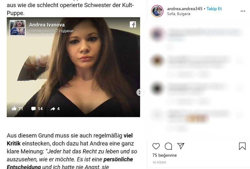 22 yaşındaki genç kız yaptırdığı dudak dolgularıyla tanınmaz hale geldi 6