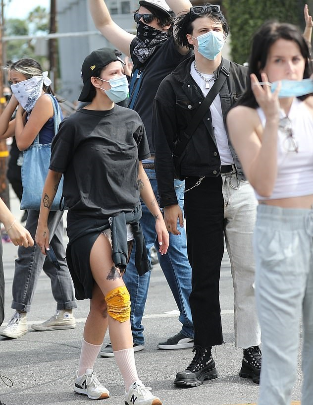 O da polis şiddetinden nasibini aldı! Ünlü şarkıcı vuruldu 4