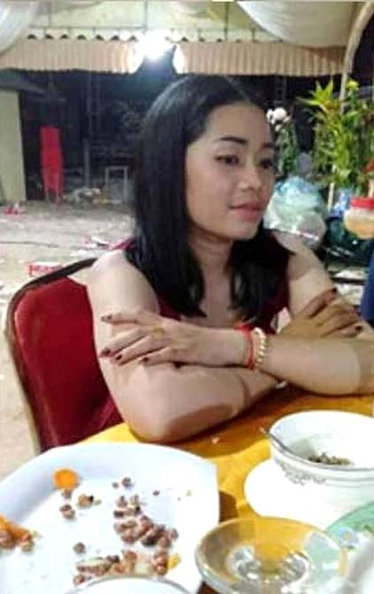 Ayrılmak isteyen kız arkadaşının yüzüne kezzap atıp kolunu satırla kesti 5