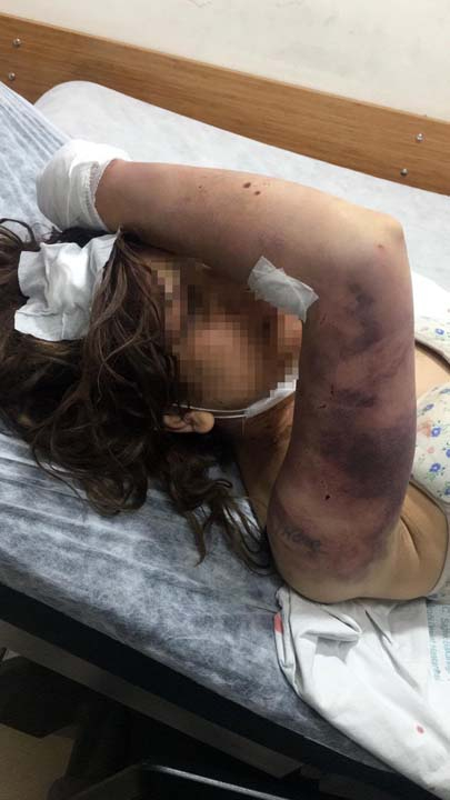 Şanlıurfa'da kan donduran olay! Günlerce işkence etti, kerpetenle tırnaklarını söktü 10