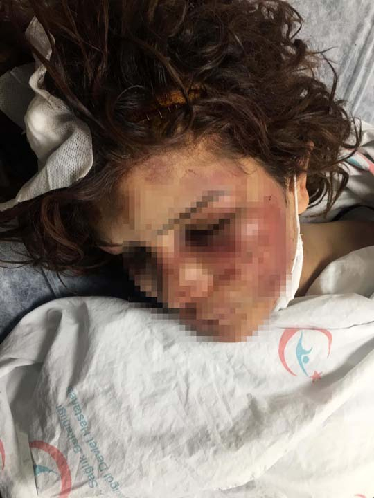 Şanlıurfa'da kan donduran olay! Günlerce işkence etti, kerpetenle tırnaklarını söktü 11
