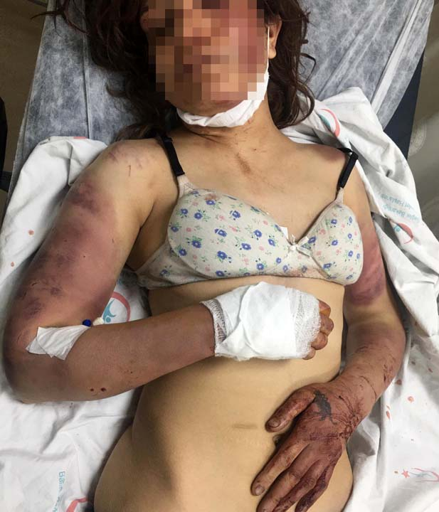 Şanlıurfa'da kan donduran olay! Günlerce işkence etti, kerpetenle tırnaklarını söktü 6