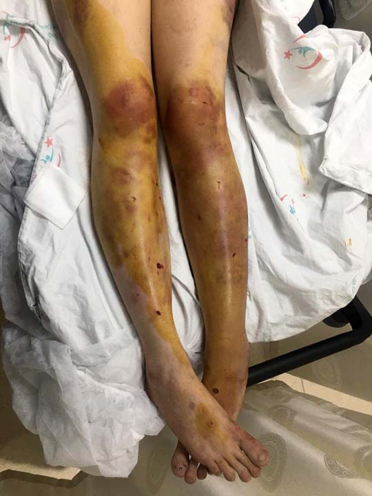 Şanlıurfa'da kan donduran olay! Günlerce işkence etti, kerpetenle tırnaklarını söktü 7