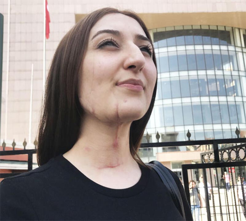 Rabia Kaçmaz'a falçatayla dehşeti yaşatan Emre Çiçek: Pişmanım ancak olay abartılıyor 8