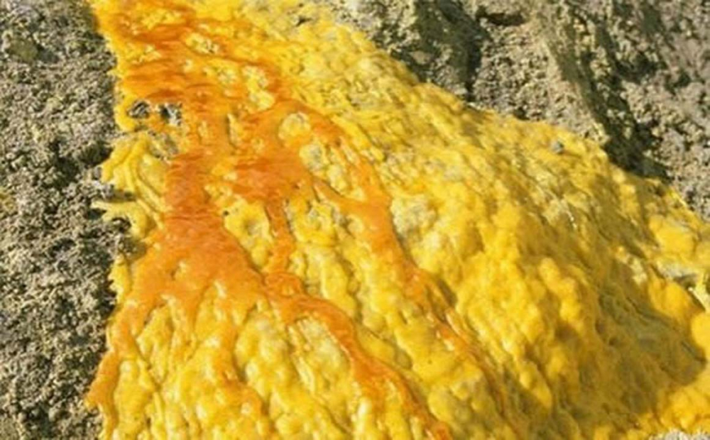 Üç farklı ülke, üç farklı yaşam! İşte ölüme savaş açan insanlar 5