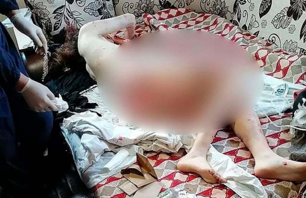 10 sokak köpeği, saldırdıkları genç kadını paramparça etti! 1