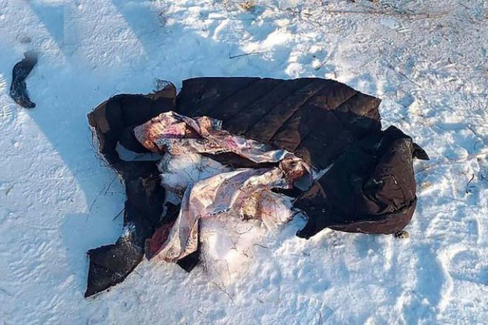 10 sokak köpeği, saldırdıkları genç kadını paramparça etti! 3