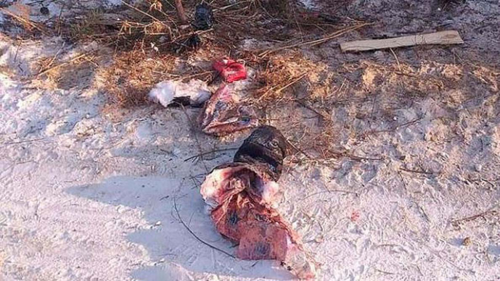 10 sokak köpeği, saldırdıkları genç kadını paramparça etti! 5