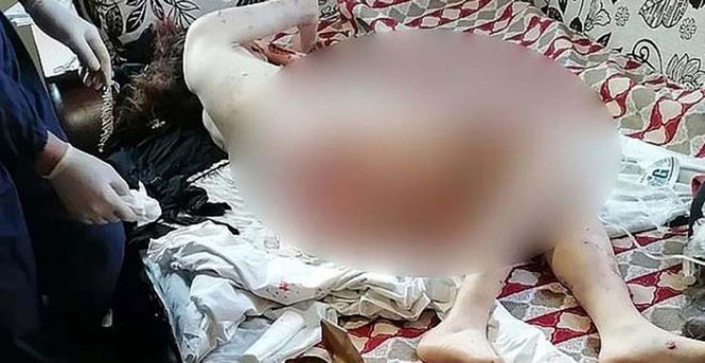 10 sokak köpeği, saldırdıkları genç kadını paramparça etti! 7