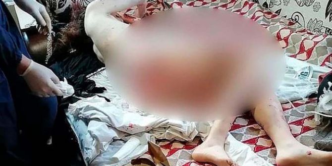 10 sokak köpeği, saldırdıkları genç kadını paramparça etti!