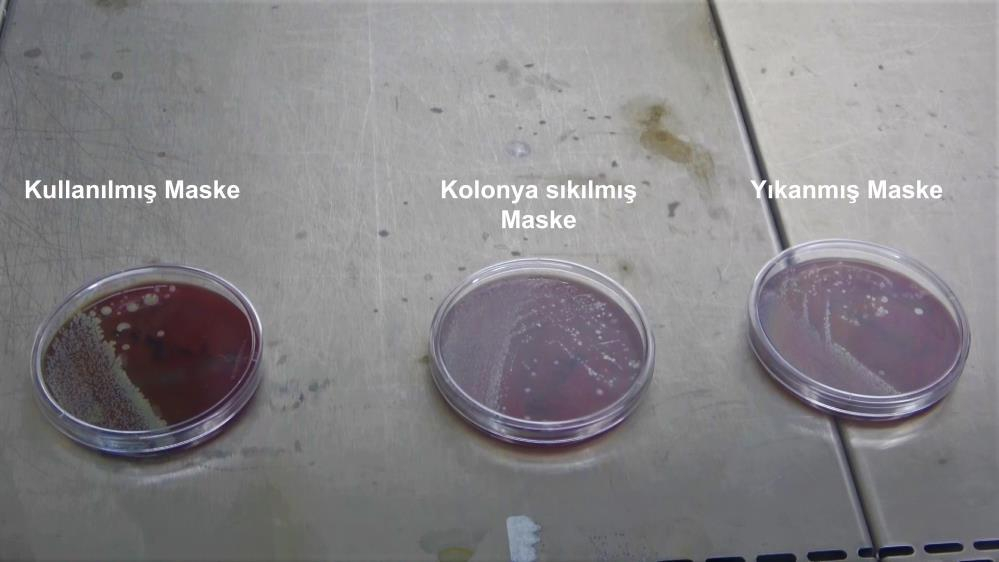 Yıkanan ve kolonya sıkılan maskelerde korkutan sonuç! Sakın yapmayın! 8