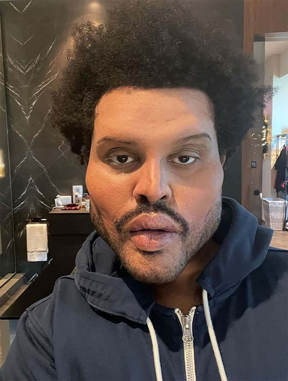 The Weeknd, yüz bandajlarının nedenini açıkladı 5