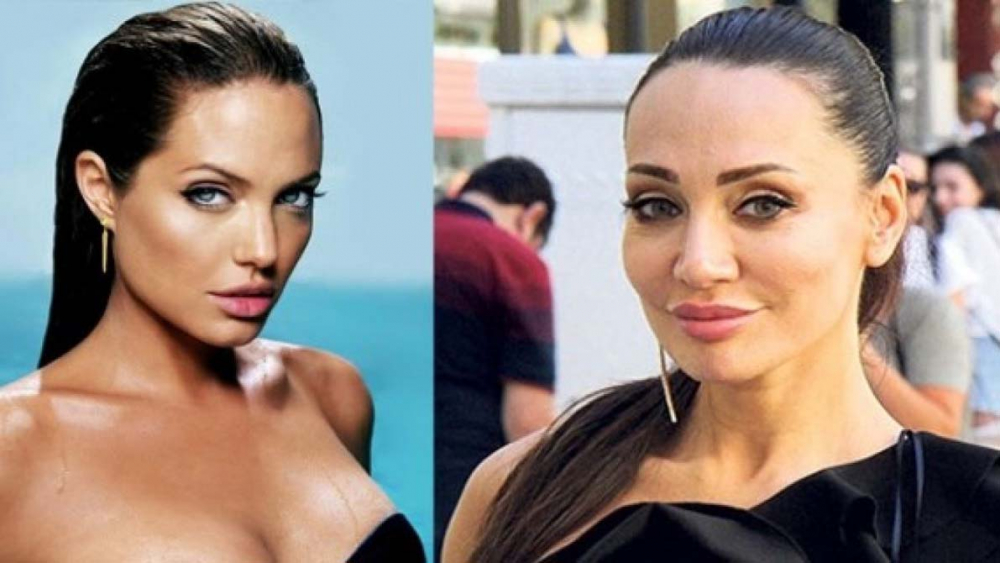 Yerli Angelina Jolie olarak bilinen Umut Akyürek, yüzüne yaptırdığı operasyonla bambaşka biri oldu! 6