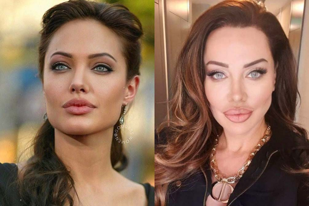 Yerli Angelina Jolie olarak bilinen Umut Akyürek, yüzüne yaptırdığı operasyonla bambaşka biri oldu! 8